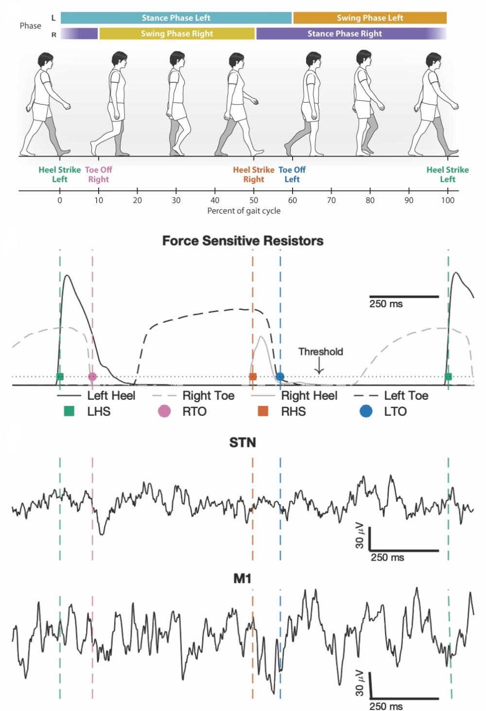 Adaptive Deep Brain Stimulation Wang Lab Unraveling Circuit